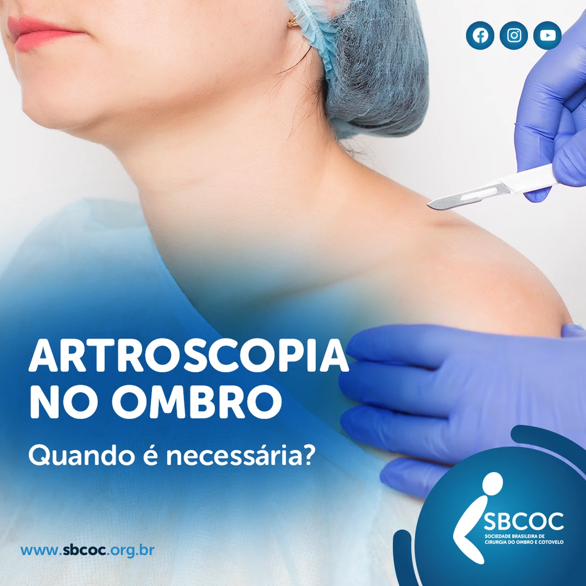 Artroscopia no ombro, quando é necessária?