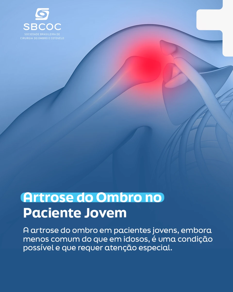 Artrose do ombro em pacientes jovens requer atenção a causas secundárias e impacto funcional