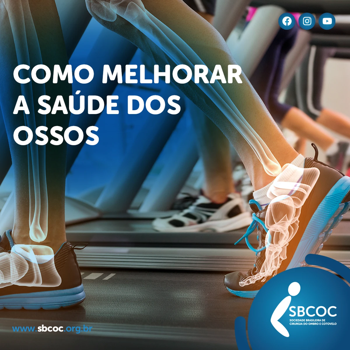 Como melhorar a saúde dos ossos