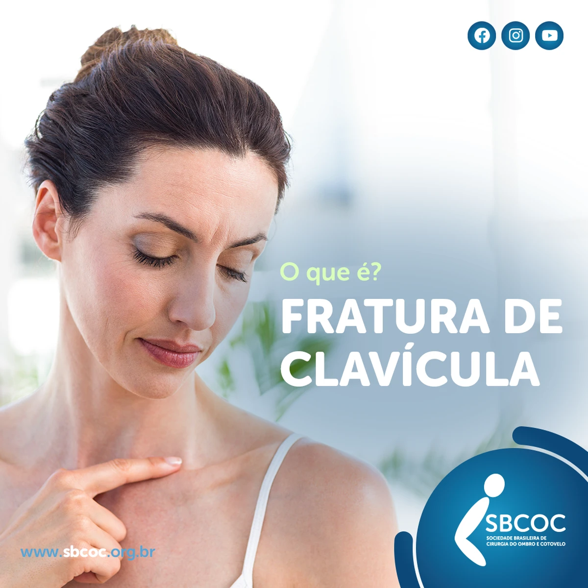 O que é fratura de clavícula?