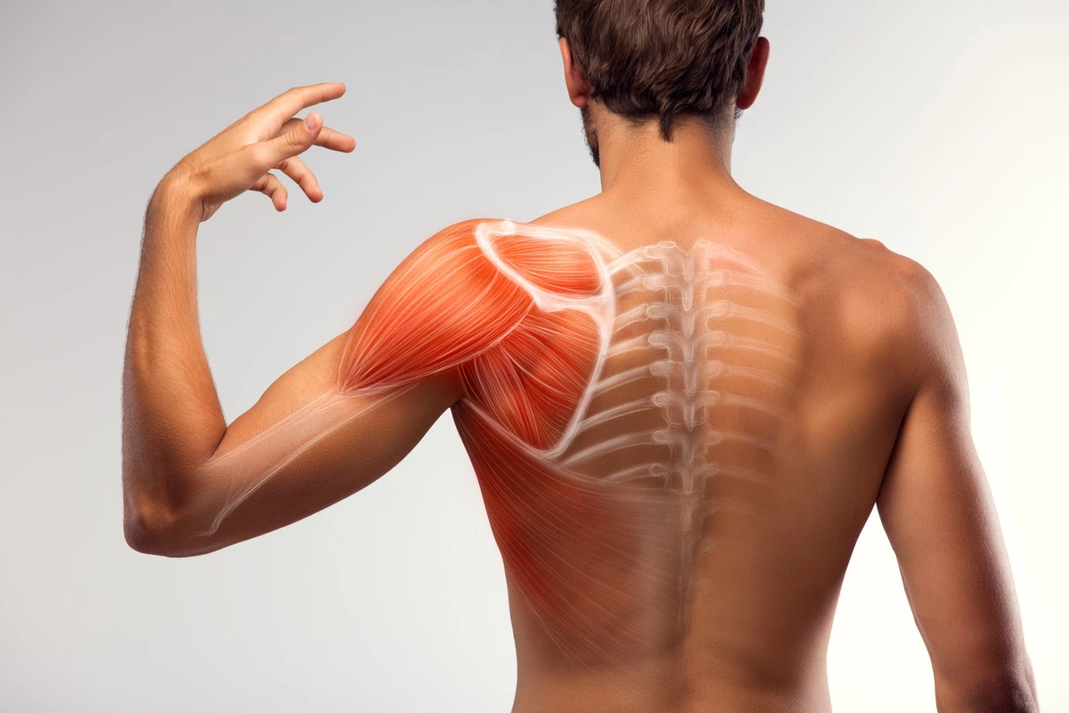 Osteocondromatose Sinovial no ombro: Saiba o que é!