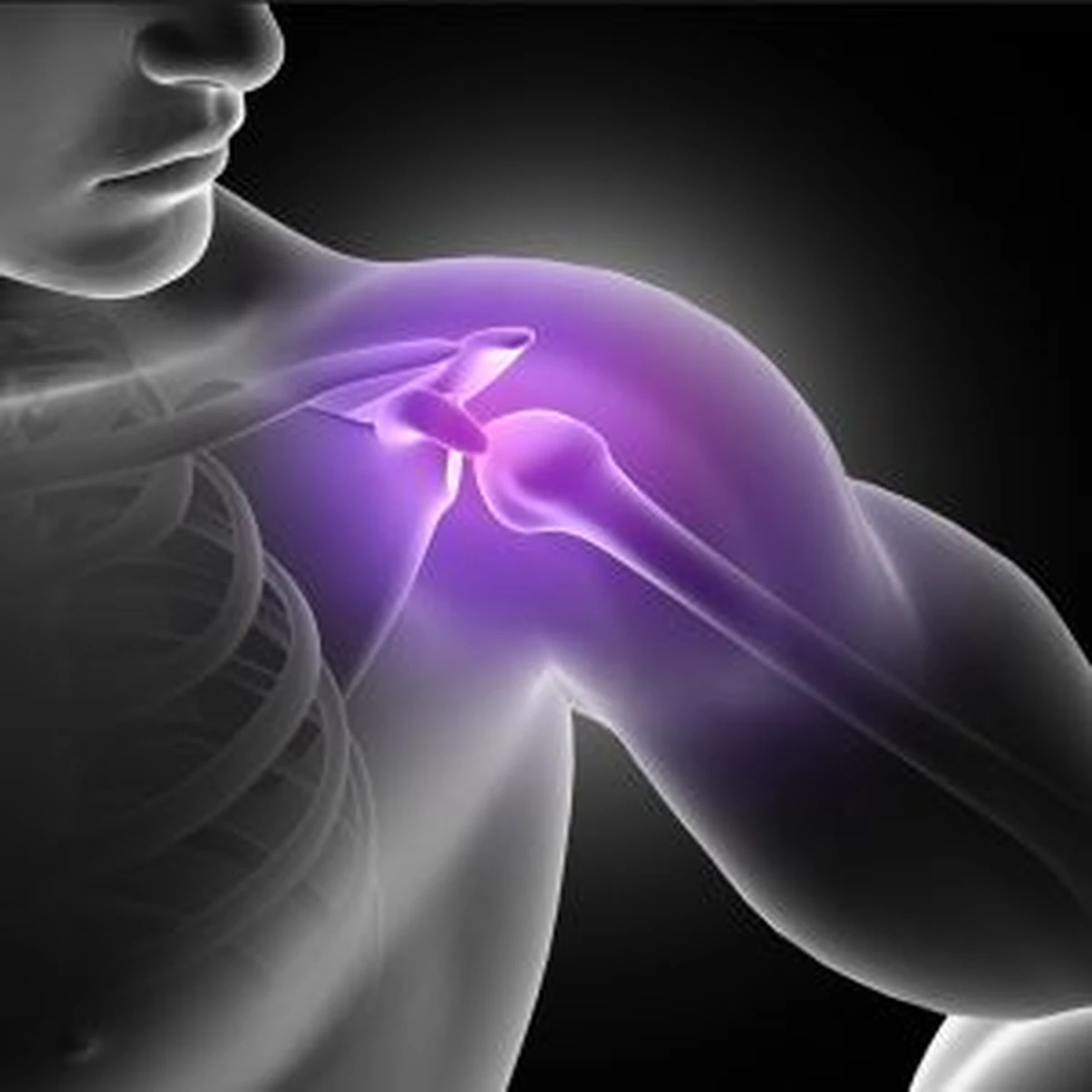 Problema comum, ombro deslocado requer tratamento adequado